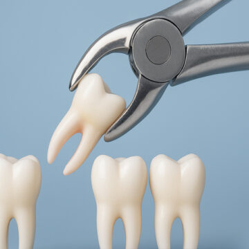Teeth Extractions Can Help You to Say Goodbye to Dental Pain