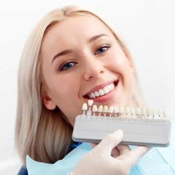 Why You Should Opt for Dental Veneers