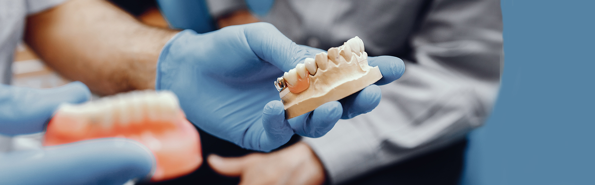 WHAT TO KNOW ABOUT  DENTAL CROWNS AND DENTAL BRIDGES?