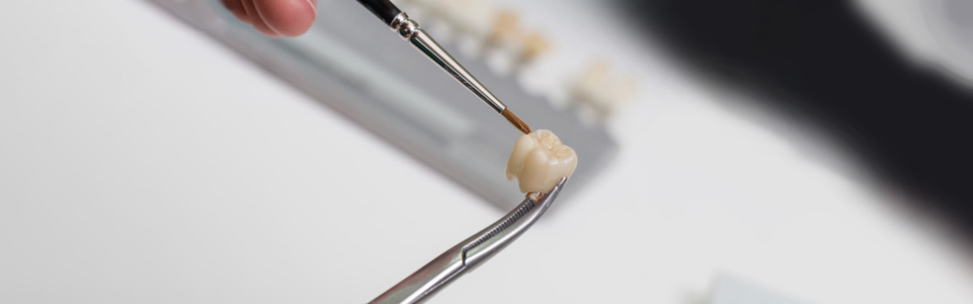 WHAT TO KNOW ABOUT  DENTAL CROWNS AND DENTAL BRIDGES?