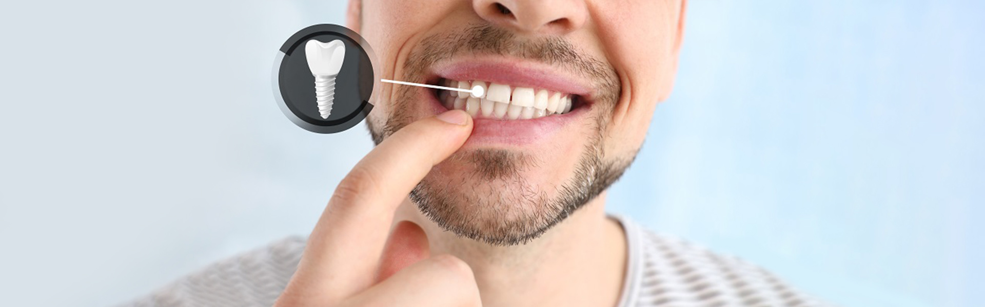 5 Care Tips for Your Dental Implant