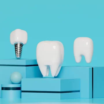 5 Care Tips for Your Dental Implant